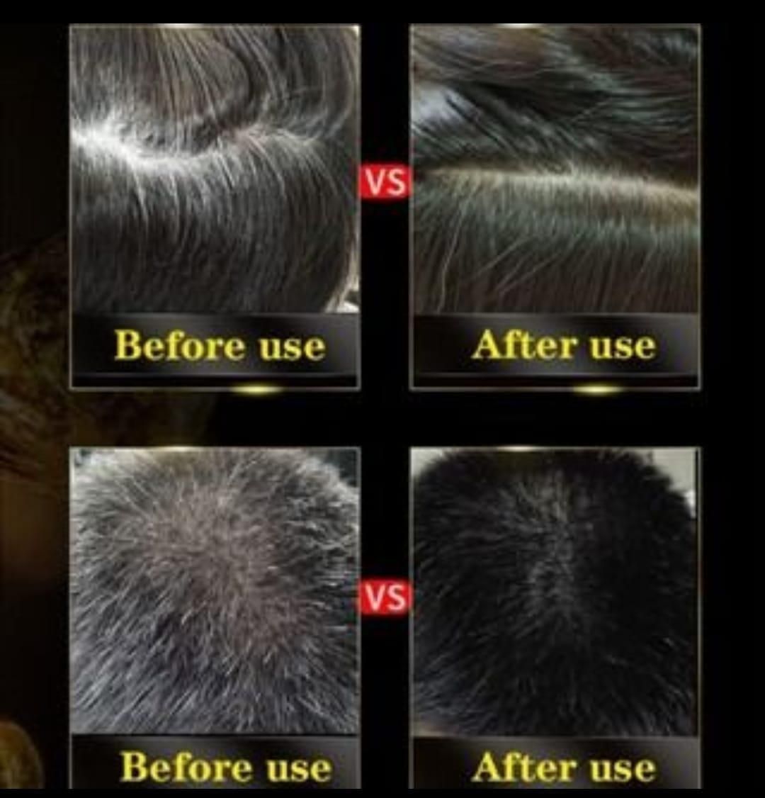 BLACK' HAIR DYE SHAMPOO 3-IN-1 (NO SIDE EFFECT)